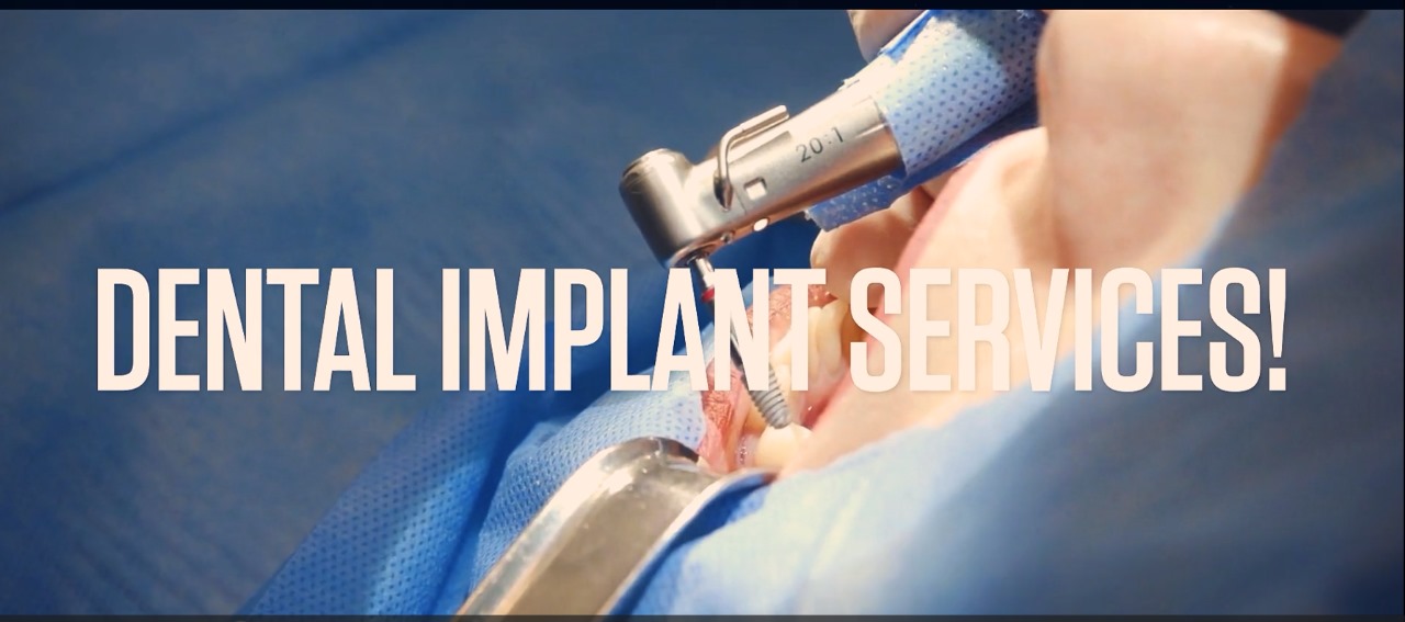 The Magic of Dental Implant