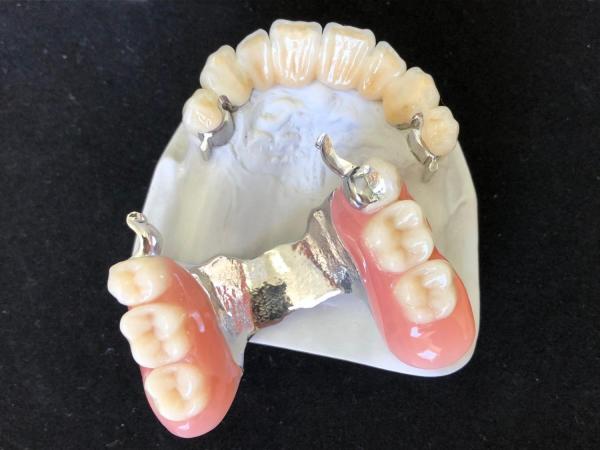 Precision Dentures in Delhi