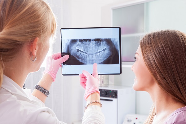 Oral and Radiographic Dental Checkups in Delhi
