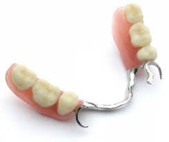 Removable Complete Dentures and Cast Partial Dentures in Delhi